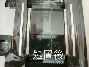 処置後